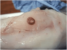 Les parasites en produit de la mer